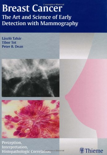 

general-books/general/breast-cancer-the-art-and-science-of-early-detection-with-mammography--9781588902597