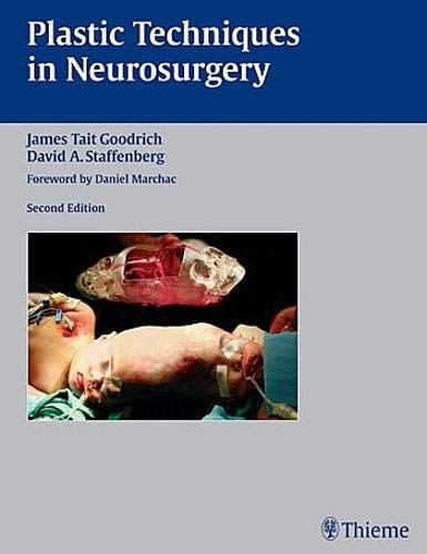 

exclusive-publishers/thieme-medical-publishers/plastic-techniques-in-neurosurgery-2ed-9781588902719