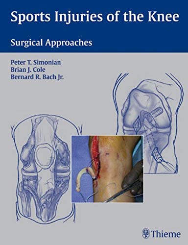 

exclusive-publishers/thieme-medical-publishers/sports-injuries-of-the-knee-surgical-approaches--9781588903068