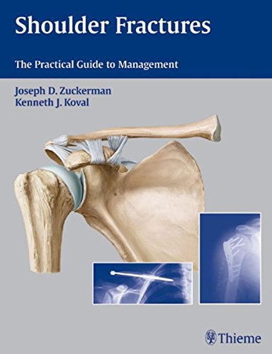 exclusive-publishers/thieme-medical-publishers/shoulder-fractures-the-practical-guide-to-management-1-e--9781588903105