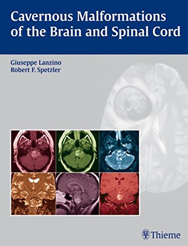 

exclusive-publishers/thieme-medical-publishers/cavernous-malformations-of-the-brain-and-spinal-cord-1-e--9781588903433