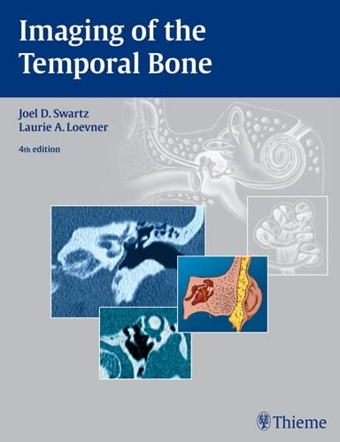 

exclusive-publishers/thieme-medical-publishers/imaging-of-the-temporal-bone-4-e--9781588903457