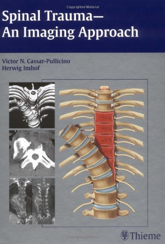 

exclusive-publishers/thieme-medical-publishers/spinal-trauma-an-imaging-approach--9781588903488