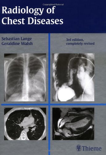 

general-books/general/radiology-of-chest-diseases-3-e--9781588904478