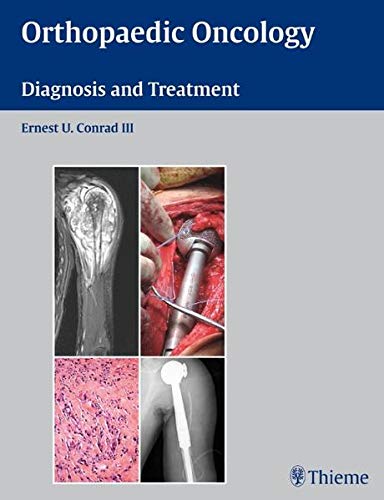 

exclusive-publishers/thieme-medical-publishers/orthopaedic-oncology-diagnosis-and-treatment--9781588905239