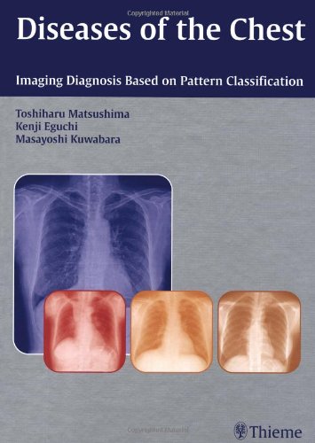

general-books/general/diseases-of-the-chest-imaging-diagnosis-based-on-pattern-classification--9781588905628
