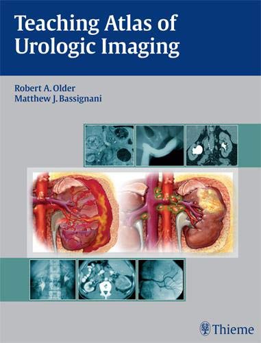 

mbbs/4-year/teaching-atlas-of-urologic-imaging-9781604060164
