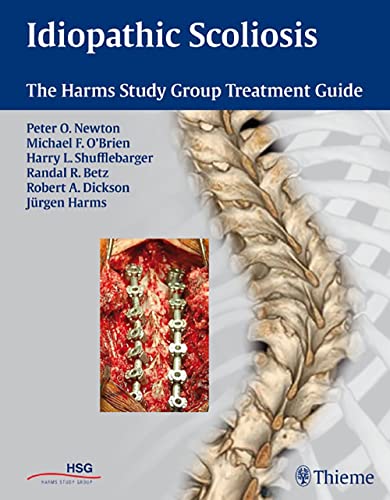 

exclusive-publishers/thieme-medical-publishers/idiopathic-scoliosis-the-harms-study-group-treatment-guide-1-e--9781604060249