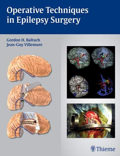 

surgical-sciences/nephrology/operative-techniques-in-epilepsy-surgery-1-e-9781604060300