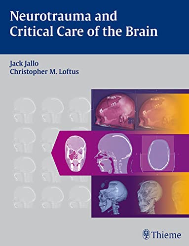 

exclusive-publishers/thieme-medical-publishers/neurotrauma-and-critical-care-of-the-brain--9781604060324
