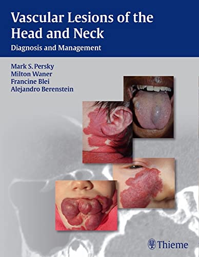 

surgical-sciences//vascular-lesions-of-the-head-and-neck-diagnosis-and-management-1-e-9781604060591