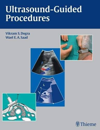 

mbbs/4-year/ultrasound-guided-procedures-1-e--9781604061703