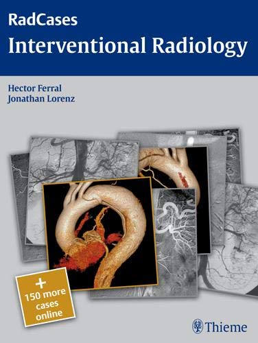 

exclusive-publishers/thieme-medical-publishers/radcases-interventional-radiology-1-e--9781604061772