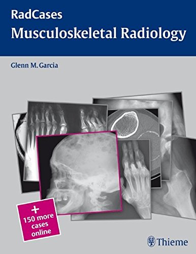 

exclusive-publishers/thieme-medical-publishers/radcases-musculoskeletal-radiology-1-e--9781604061796
