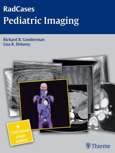 

exclusive-publishers/thieme-medical-publishers/radcases-pediatric-imaging--9781604061819