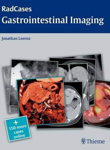 

exclusive-publishers/thieme-medical-publishers/radcases-gastrointestinal-imaging-9781604061833