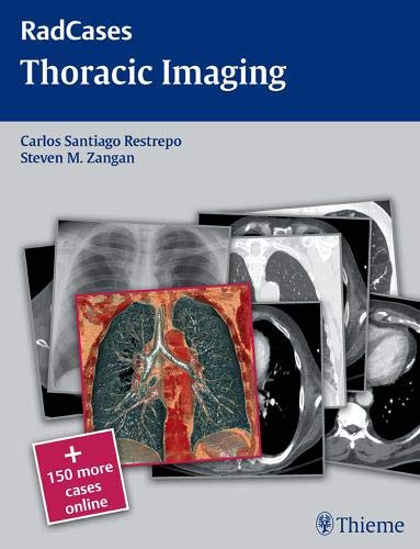 

mbbs/4-year/radcases-thoracic-imaging-1-e-9781604061871