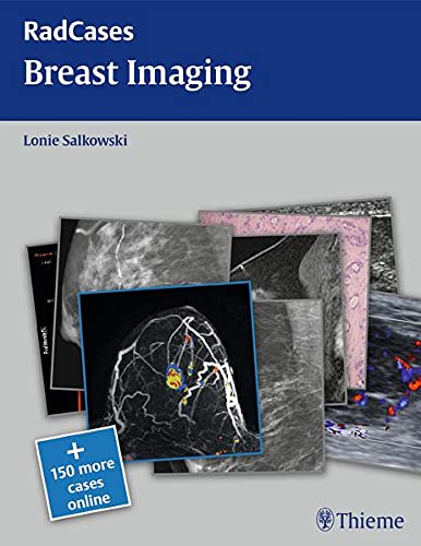 

exclusive-publishers/thieme-medical-publishers/radcases-breast-imaging-9781604061918