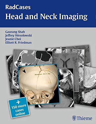 

exclusive-publishers/thieme-medical-publishers/radcases-head-and-neck-imaging-1-e--9781604061932