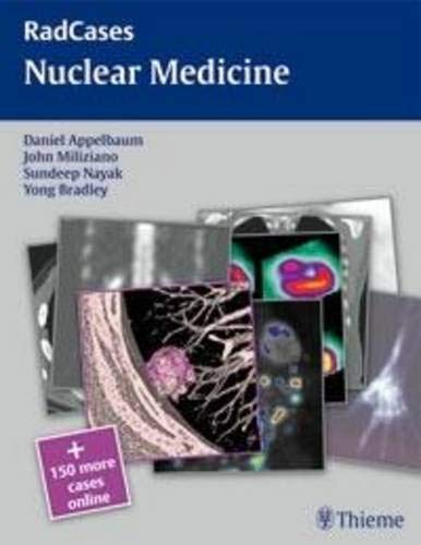 

exclusive-publishers/thieme-medical-publishers/radcases-nuclear-medicine-1-e--9781604062304