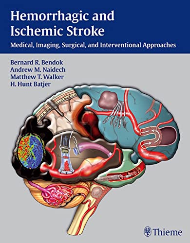 

exclusive-publishers/thieme-medical-publishers/hemorrhagic-and-ischemic-stroke-9781604062342