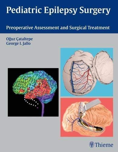 

exclusive-publishers/thieme-medical-publishers/pediatric-epilepsy-surgery-preoperative-assessment-and-surgical-treatment-1-e--9781604062540