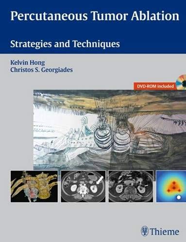 

exclusive-publishers/thieme-medical-publishers/percutaneous-tumor-ablation-strategies-and-techniques-1-e-9781604063066