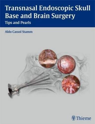 

mbbs/4-year/transnasal-endoscopic-skull-base-and-brain-surgery--9781604063103