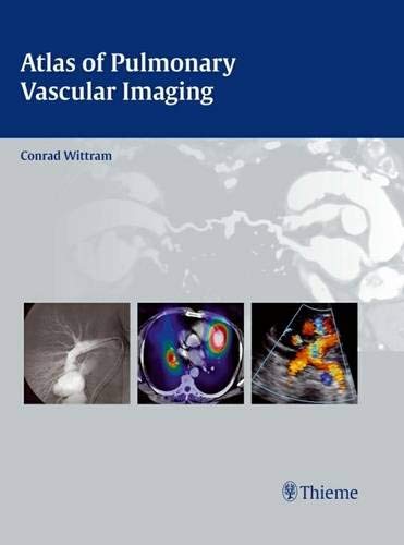 mbbs/4-year/atlas-of-pulmonary-vascular-imaging-1-e--9781604063127
