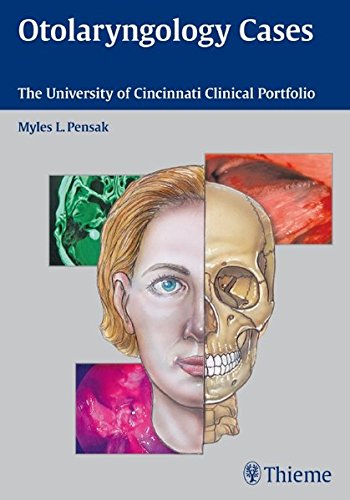

exclusive-publishers/thieme-medical-publishers/otolaryngology-cases-the-university-of-cincinnati-clinical-portfolio-1-e--9781604063202