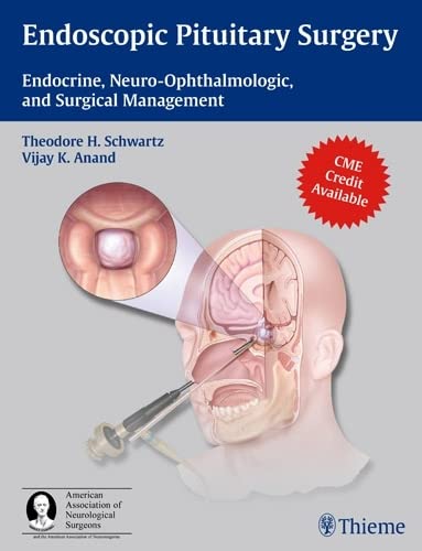 

exclusive-publishers/thieme-medical-publishers/endoscopic-pituitary-surgery-endocrine-neuro-ophthalmologic-and-surgical-management-1-e--9781604063479