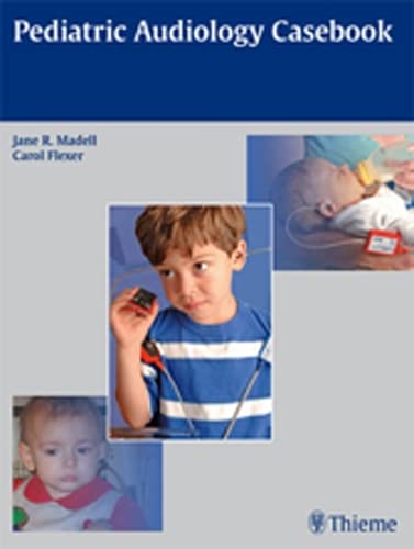 

exclusive-publishers/thieme-medical-publishers/pediatric-audiology-casebook-1-ed--9781604063844