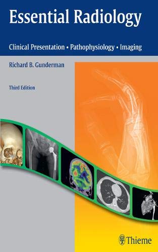 

exclusive-publishers/thieme-medical-publishers/essential-radiology-clinical-presentation-pathophysiology-imaging-3-e--9781604065732