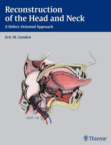 

exclusive-publishers/thieme-medical-publishers/reconstruction-of-the-head-and-neck-9781604065763