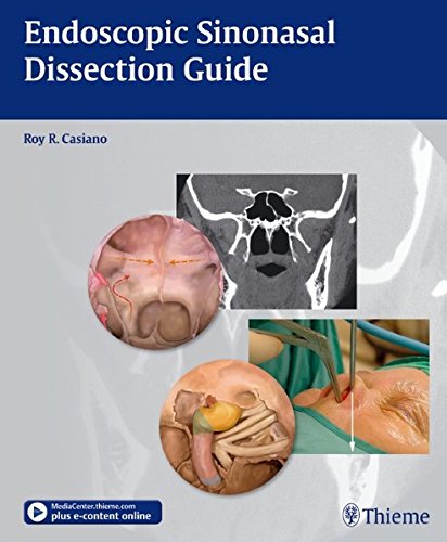 

general-books/general/endoscopic-sinonasal-dissection-guide-pb--9781604065879