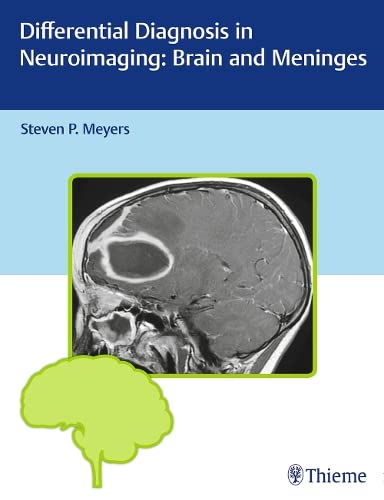 

exclusive-publishers/thieme-medical-publishers/differential-diagnosis-in-neuroimaging-brain-and-meninges-1-e--9781604067002