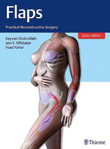 

exclusive-publishers/thieme-medical-publishers/flaps-practical-reconstructive-surgery-1-e--9781604067156