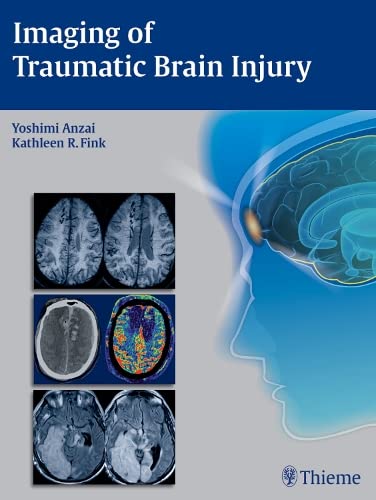 

exclusive-publishers/thieme-medical-publishers/imaging-of-traumatic-brain-injury-1-e--9781604067286