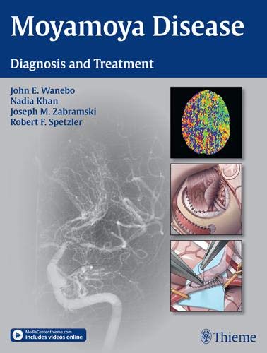 

clinical-sciences/neurology/moyamoya-disease-9781604067309