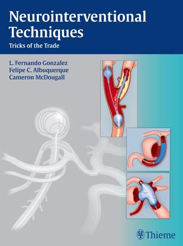

exclusive-publishers/thieme-medical-publishers/neurointerventional-techniques-tricks-of-the-trade-1-e--9781604067576