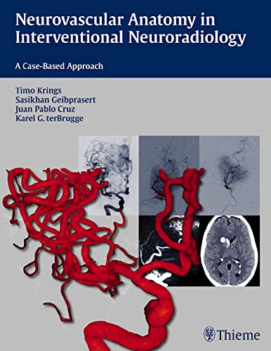 

exclusive-publishers/thieme-medical-publishers/neurovascular-anatomy-in-interventional-neuroradiology-a-case-based-approach-1-e--9781604068399