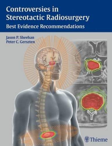 

exclusive-publishers/thieme-medical-publishers/controversies-in-stereotactic-radiosurgery-best-evidence-recommendations-1-e--9781604068412