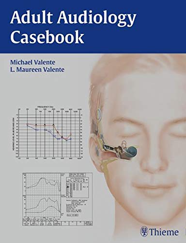 

exclusive-publishers/thieme-medical-publishers/adult-audiology-casebook-1-e--9781604068504