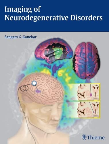 

exclusive-publishers/thieme-medical-publishers/imaging-of-neurodegenerative-disorders-1-e--9781604068542