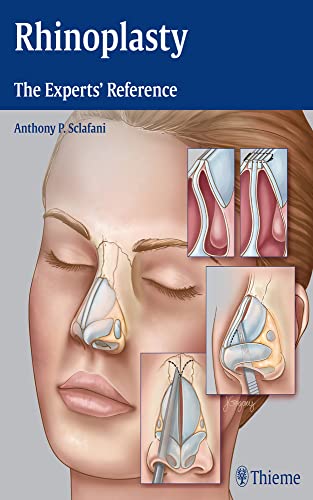 

exclusive-publishers/thieme-medical-publishers/rhinoplasty-the-experts-reference-1-e--9781604068672
