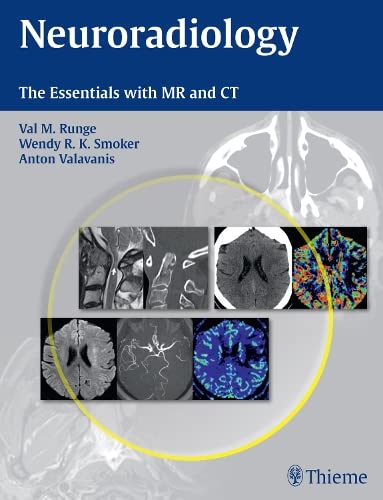

exclusive-publishers/thieme-medical-publishers/neuroradiology-the-essentials-with-mr-and-ct-1-e--9781604069167