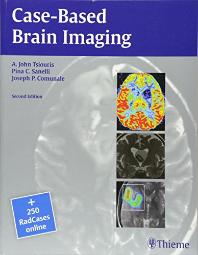 

mbbs/4-year/case--based-brain-imaging-2ed-9781604069532