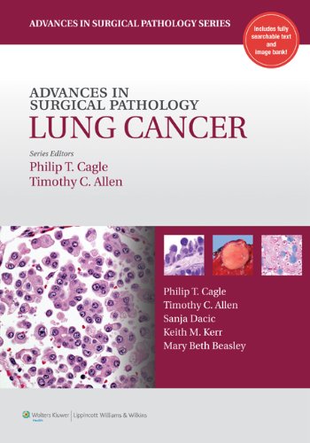 

mbbs/3-year/advances-in-surgical-pathology-lung-cancer--9781605475912
