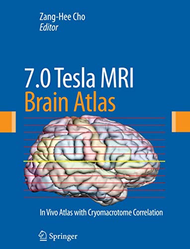 

surgical-sciences/nephrology/7-0-tesla-mri-brain-atlas-in-vivo-atlas-with-cryomacrotome-correlation-9781607611530