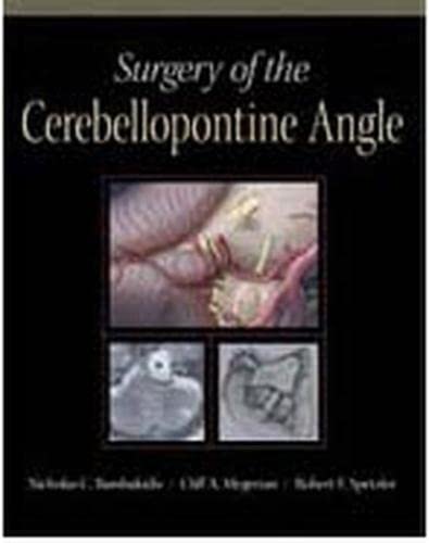 

mbbs/4-year/surgery-of-the-cerebellopontine-angle-9781607950011